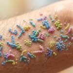 microbiote cutanée